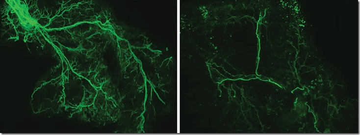 20240127_BMENews_BMEN202401270001_SNS-in-fat-tissues_ImaiStudy